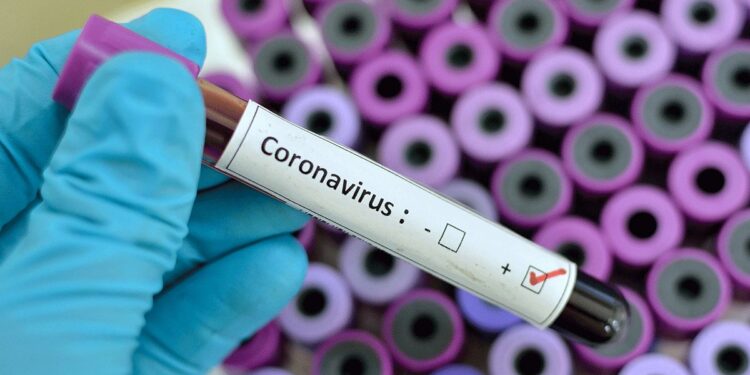 Bilant-Coronavirus