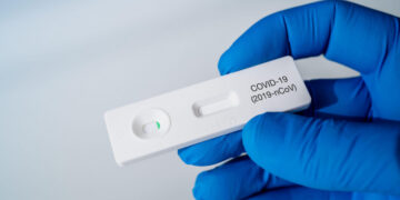 teste-saliva-scoli