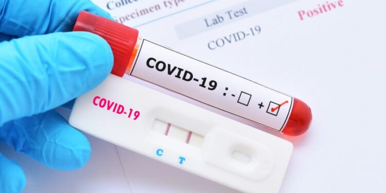 COVID-19