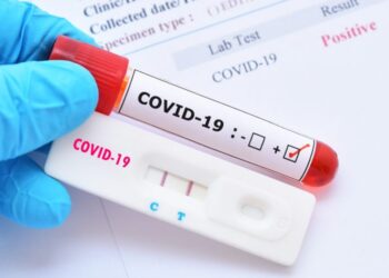 test-COVID-19