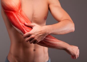 dureri-musculare-remedii-plante