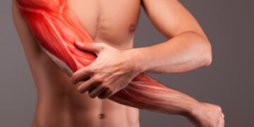 dureri-musculare-remedii-plante
