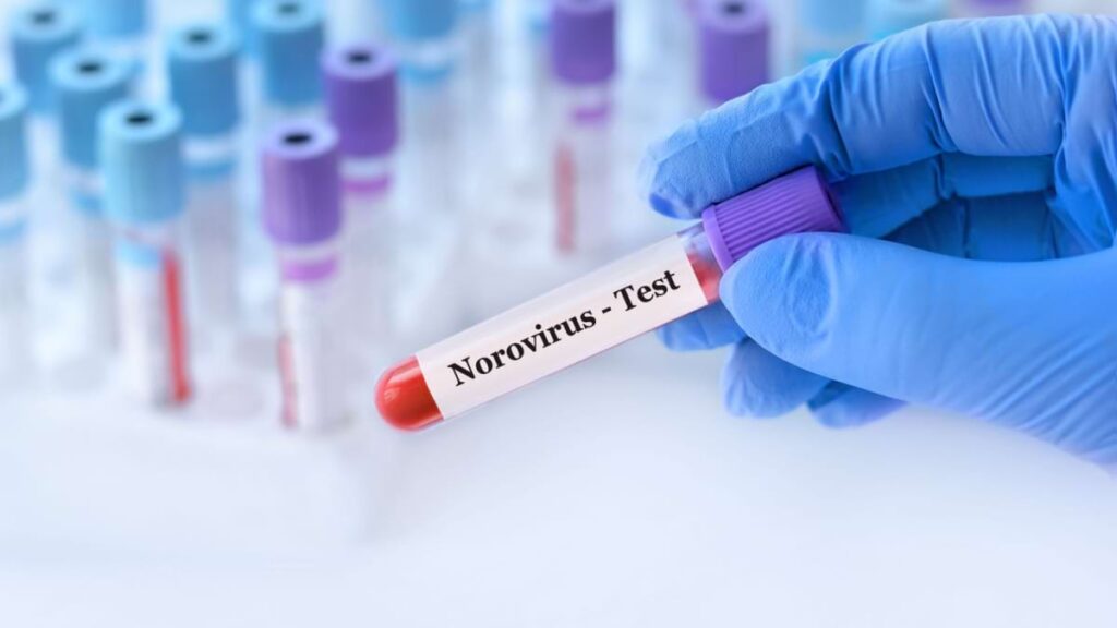 infectia-cu-norovirus