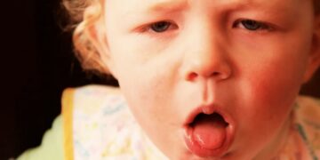 tuse-convulsiva-
