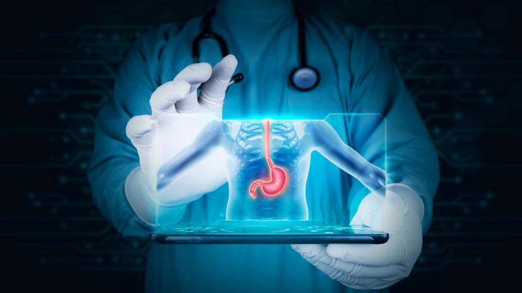 sucul-gastric