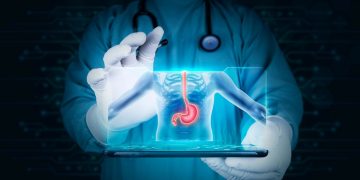 sucul-gastric