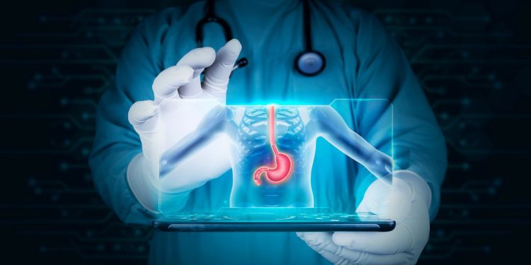 sucul-gastric