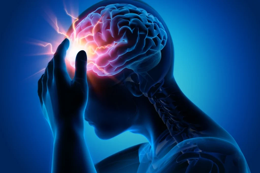epilepsie